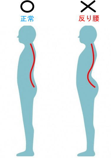 明石で骨盤矯正なら朝霧整体院　反り腰について