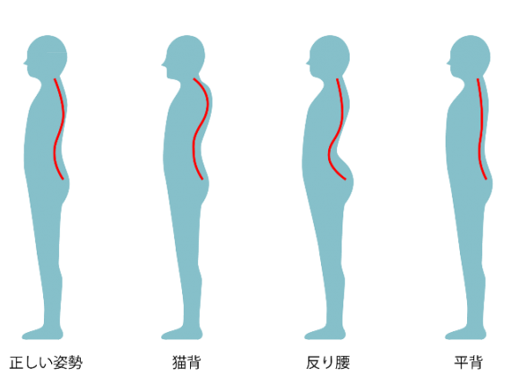 仰向けになれない平背の腰痛 明石の整体 骨盤矯正 朝霧整体院