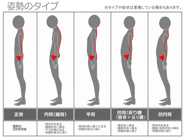 明石市　朝霧整体院　姿勢矯正　姿勢の歪み