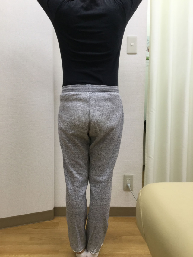 before画像