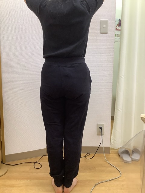 before画像